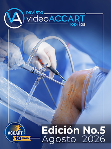 Video Accart - Edici&oacute;n 5